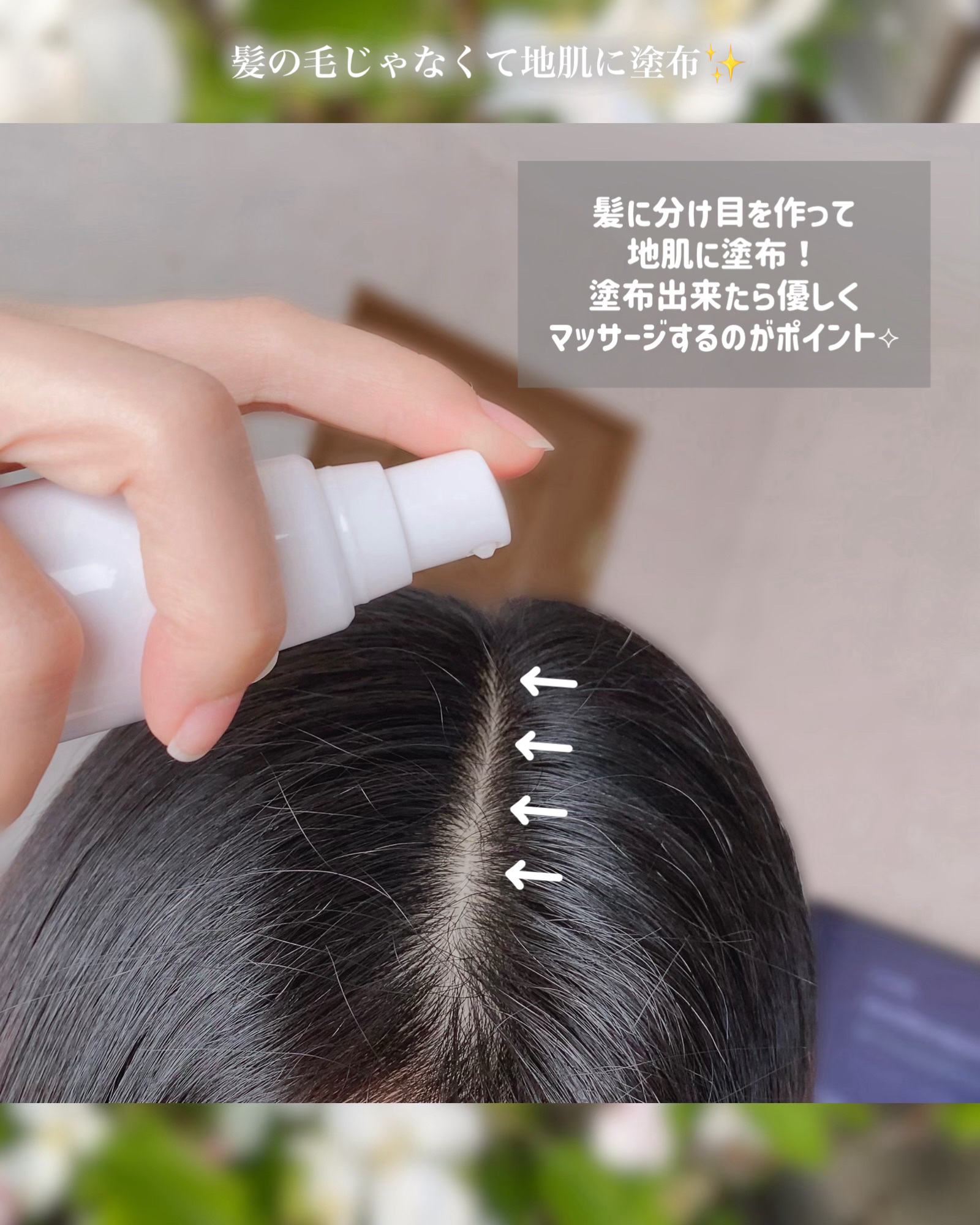 薬用育毛ローション　RANMU/RANMU/頭皮ローションを使ったクチコミ（3枚目）