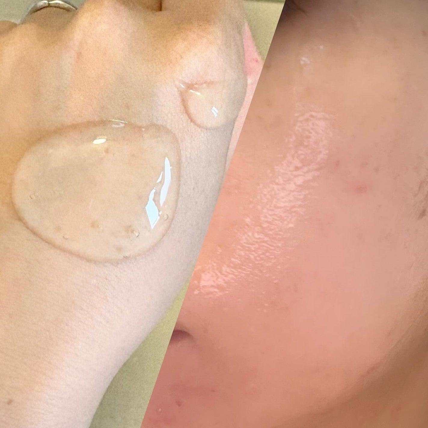 クッションジェルクレンジング R/アカラン/クレンジングジェルを使ったクチコミ(2枚目)