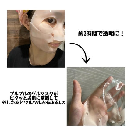 RXザ・アルファアルブチン2 ニキビ跡ケアセラム/COSRX/美容液を使ったクチコミ(4枚目)