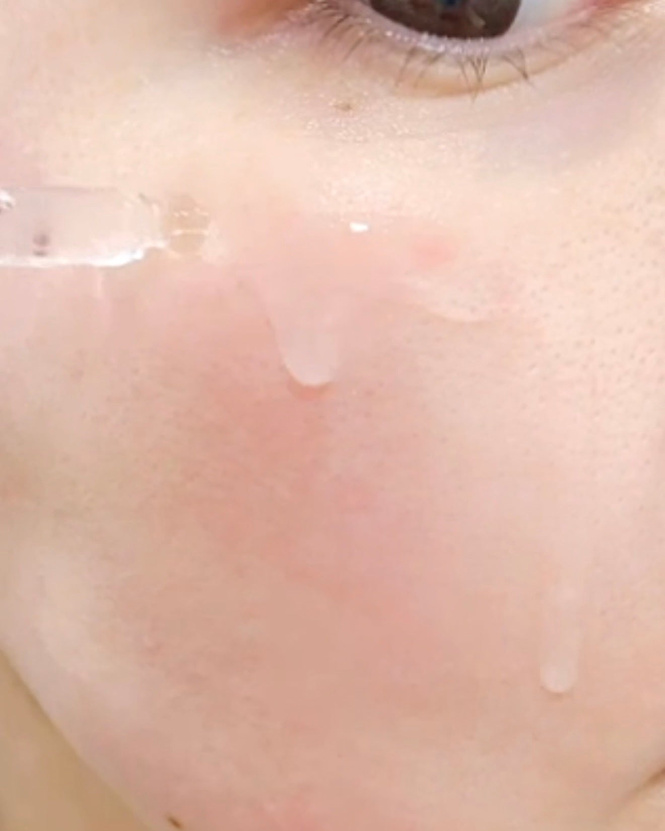 131 ポア クリアリング セラム/Celladix/美容液を使ったクチコミ(5枚目)