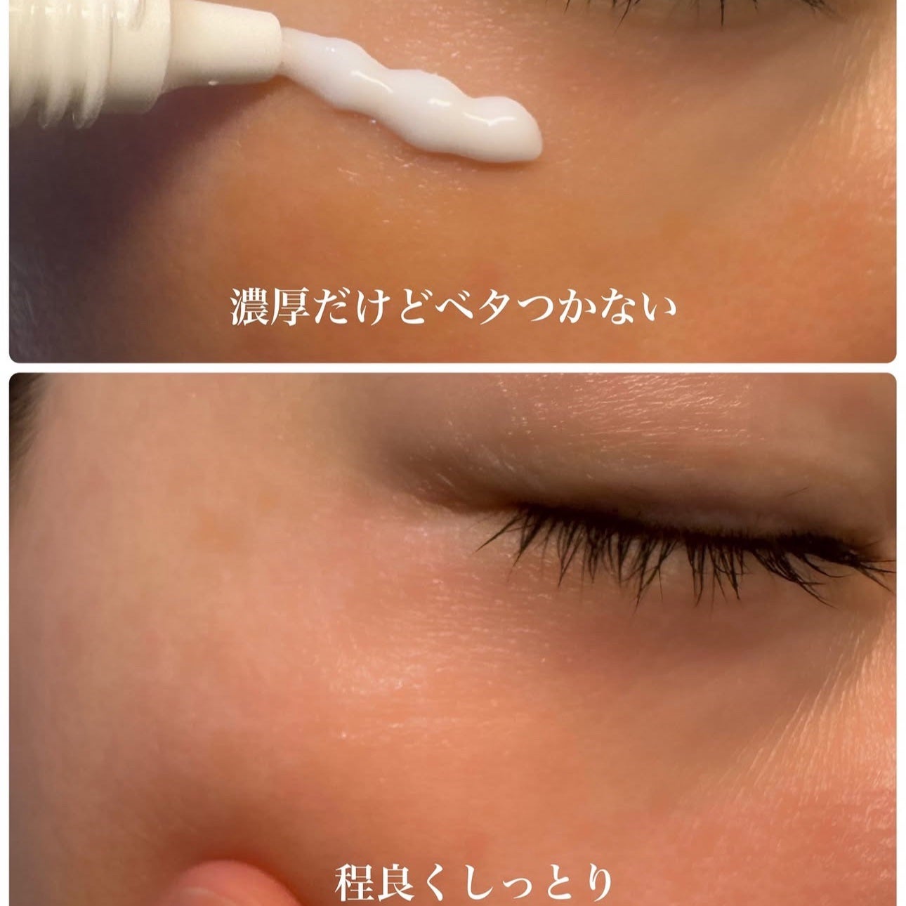 ☆scallop☆フォロバ100%☆ on LIPS 「💚\韓国で100年の歴史をもつ製薬会社発/ニキビ・トラブルケア..」(6枚目)