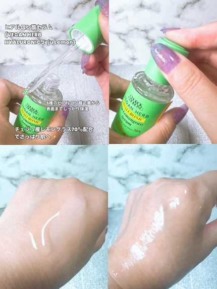 ã¢ã³ð°ãã©ãã100ð©· on LIPS ãæ¥æ¬åäžéžð¯ðµæ³šç®ã®ãŽã£ãŒã¬ã³ãã©ã³ãâšïž/CHOROKCHO..ãïŒ5æç®ïŒ