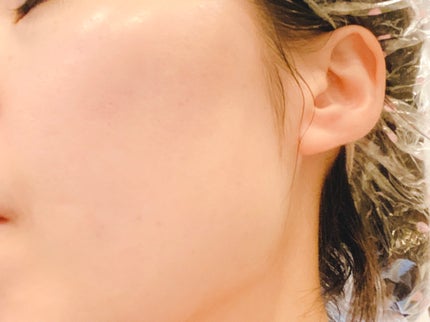 ZERO BLACKHEAD BAR/23years old/クレンジングバームを使ったクチコミ(8枚目)