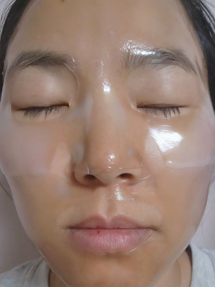 RXザ・アルファアルブチン2 ニキビ跡ケアセラム/COSRX/美容液を使ったクチコミ(9枚目)