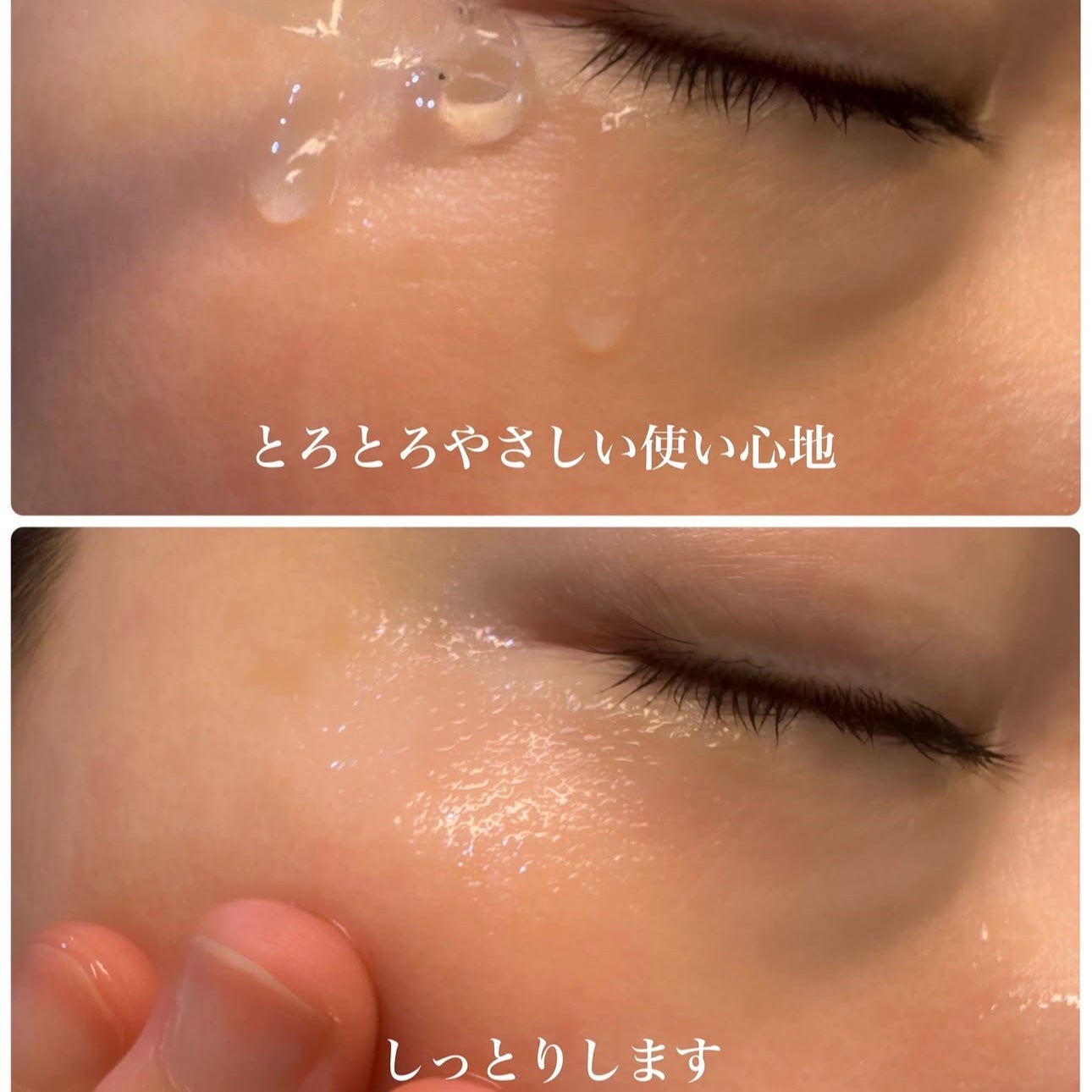 ☆scallop☆フォロバ100%☆ on LIPS 「💚\韓国で100年の歴史をもつ製薬会社発/ニキビ・トラブルケア..」(4枚目)