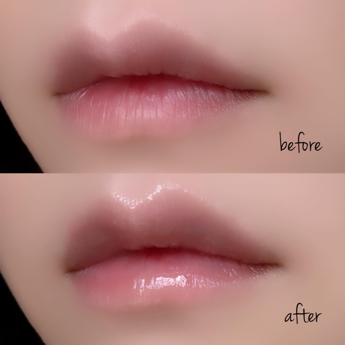 ダーマパワーX リップエッセンス/オバジ/リップ美容液を使ったクチコミ（3枚目）