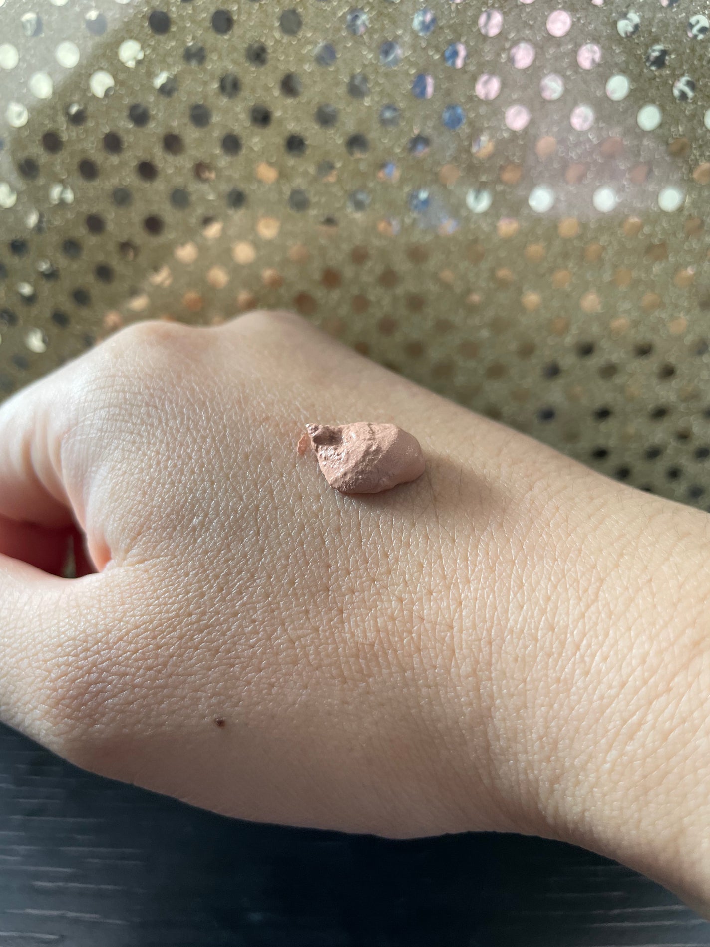 エスカメル(医薬品)/佐藤製薬/その他を使ったクチコミ(2枚目)