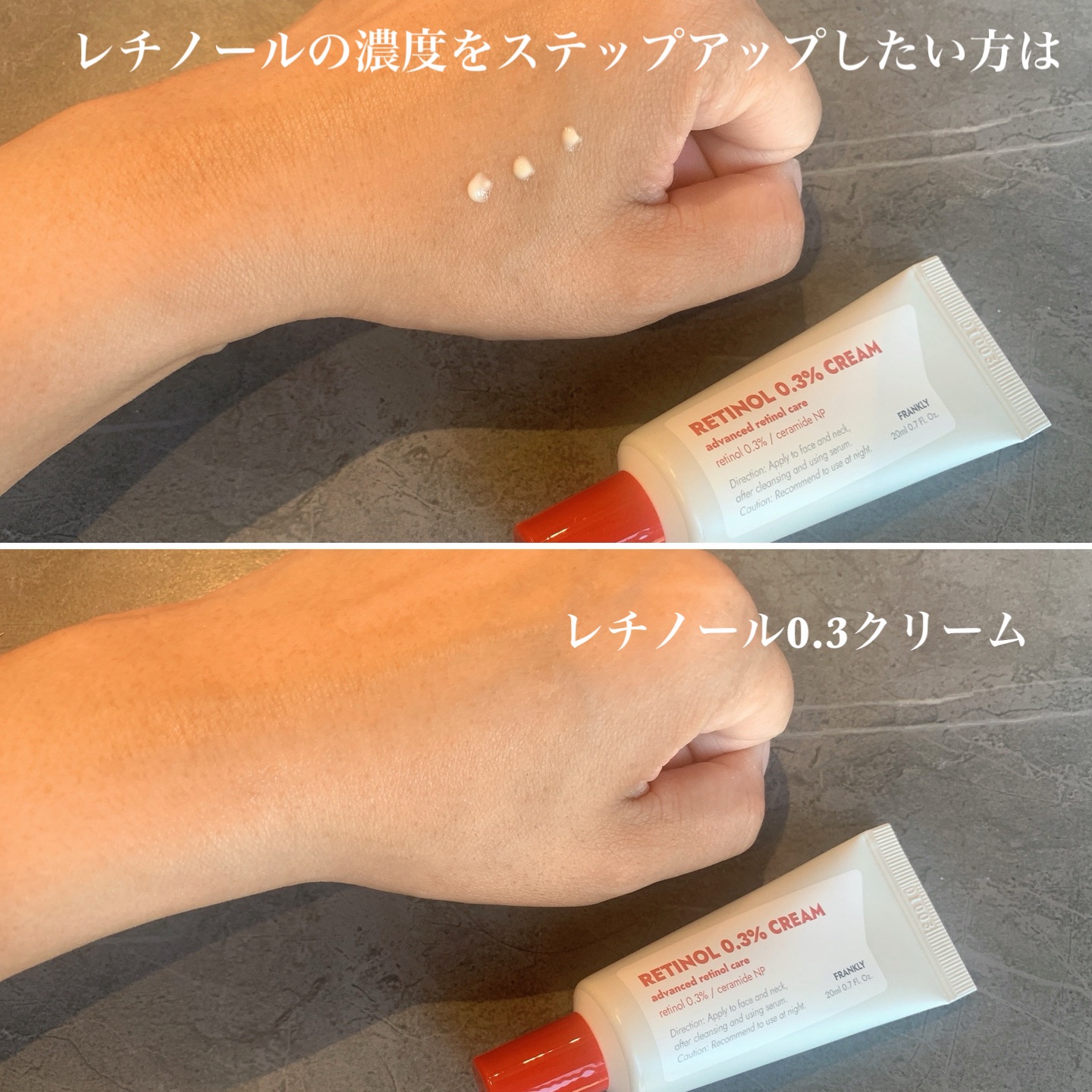 レチノール0.1％クリーム/Frankly/フェイスクリームを使ったクチコミ（3枚目）