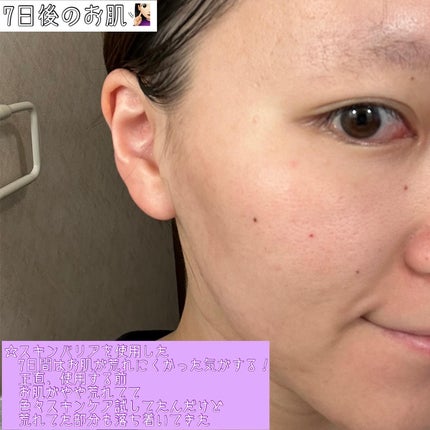 カモミールスキンバリアトナー/STARLIKE/化粧水を使ったクチコミ(5枚目)