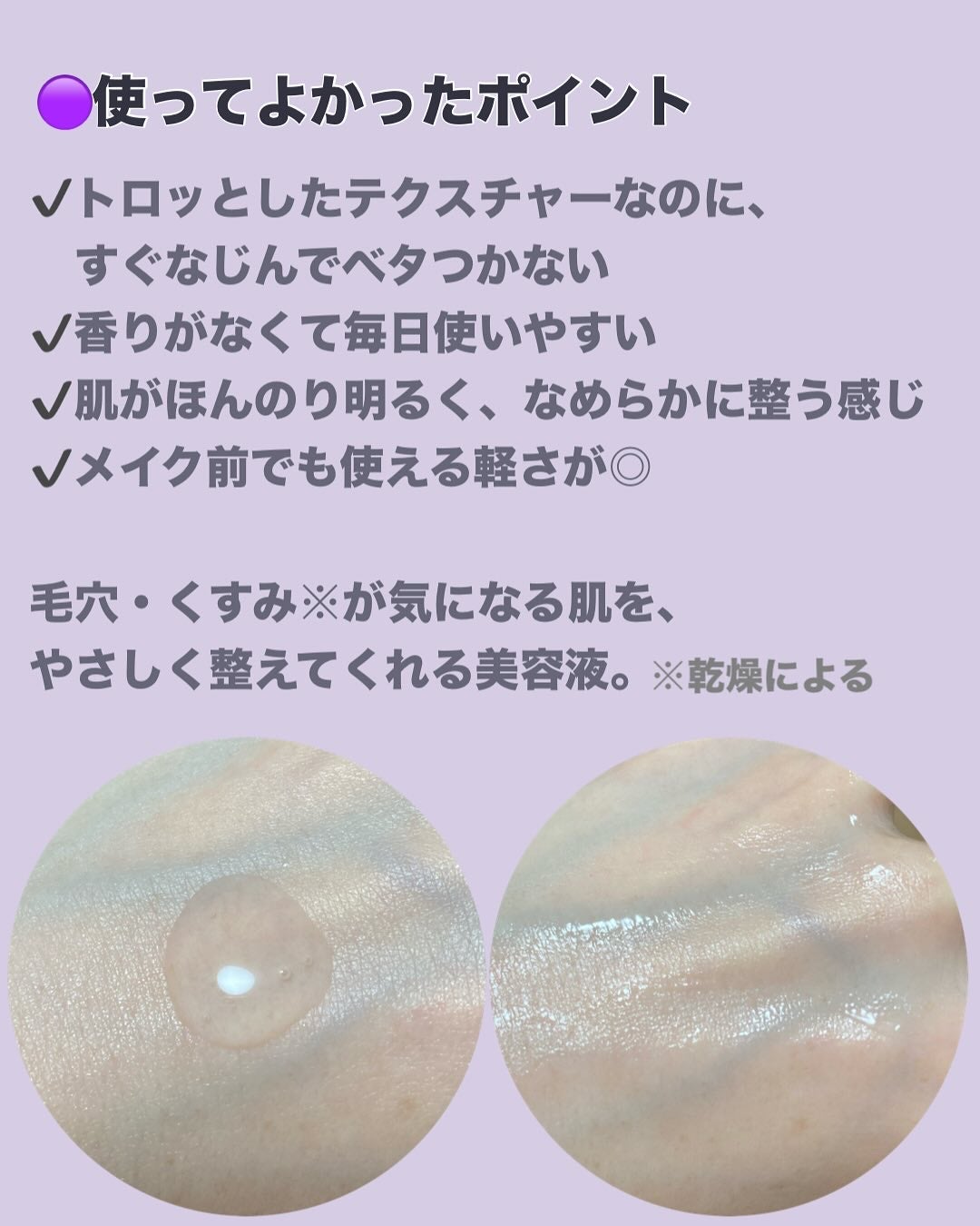 グリーンタンジェリンナイアシンアミド10ブレミッシュアンプル/goodal/美容液を使ったクチコミ(3枚目)