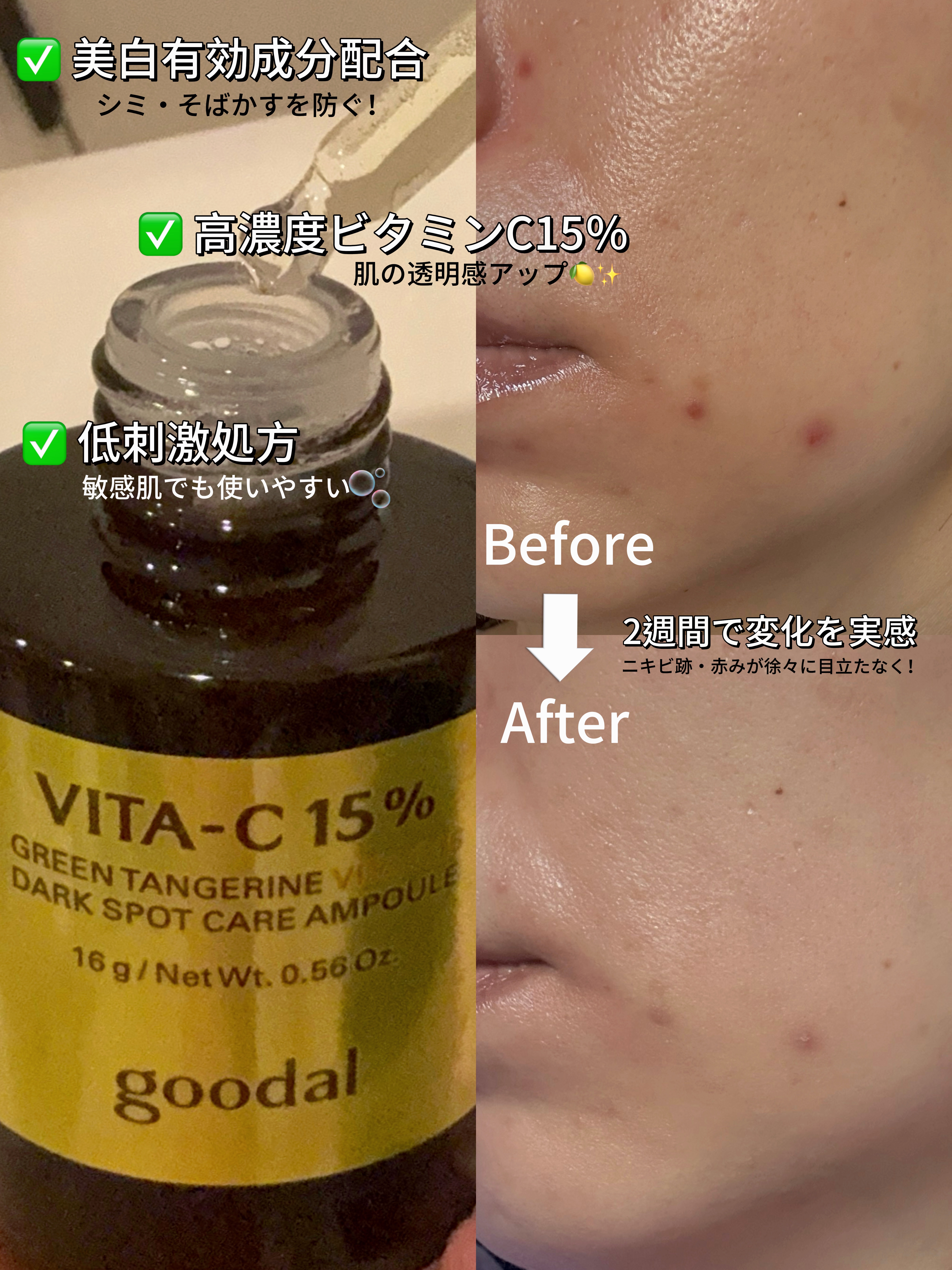 グリーンタンジェリンビタC15ダークスポットケアアンプル/goodal/美容液を使ったクチコミ（1枚目）
