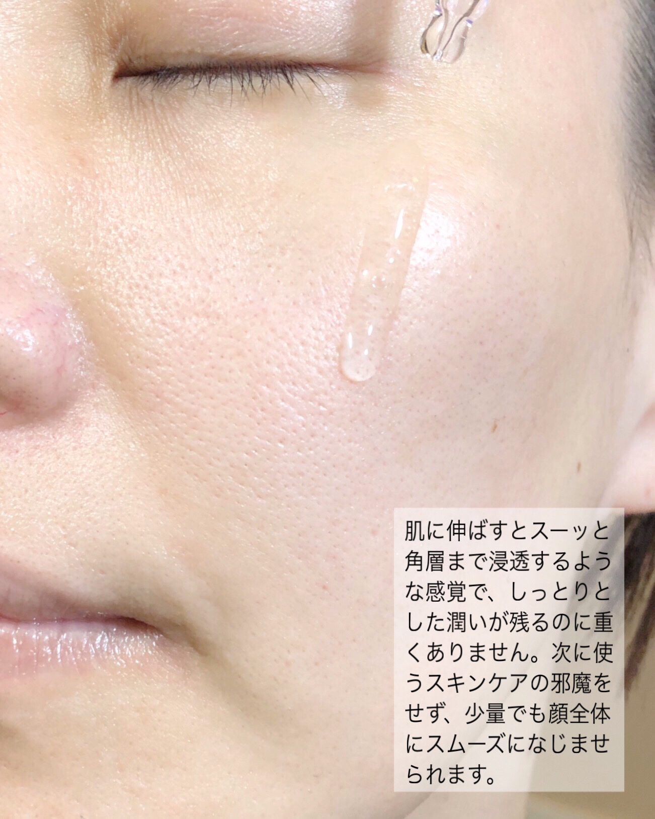 グリーンタンジェリンナイアシンアミド10ブレミッシュアンプル/goodal/美容液を使ったクチコミ（3枚目）