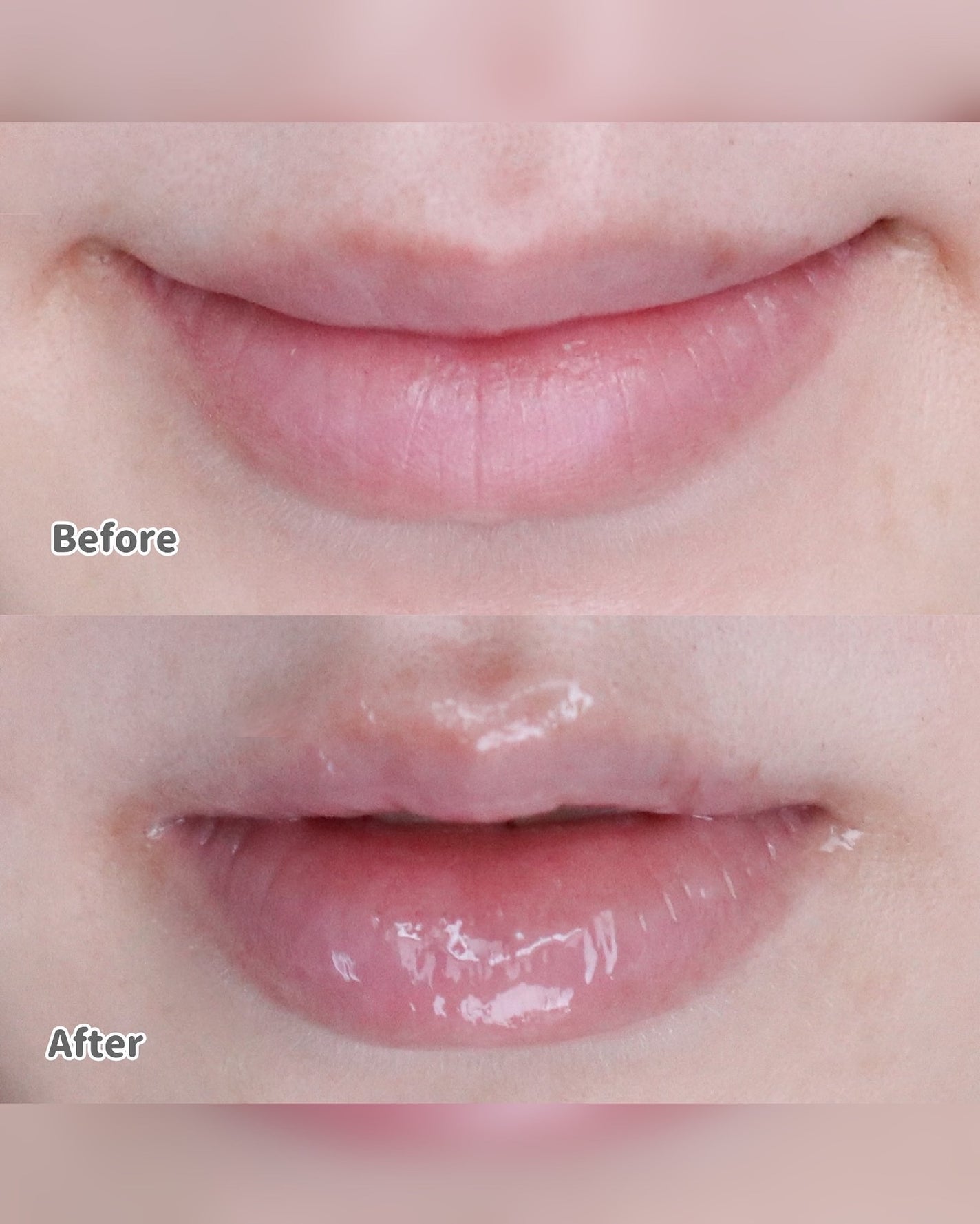 デイニードルリップ/CHOOSY/リップ美容液を使ったクチコミ(5枚目)