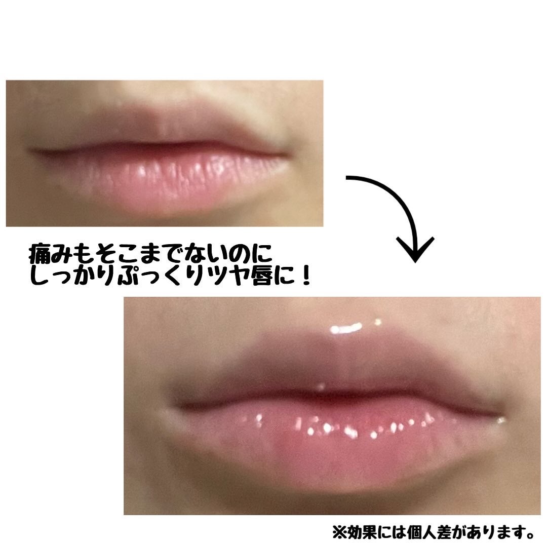 キューミ―ボムショットリッププランパー/AGARISM/リッププランパーを使ったクチコミ(3枚目)