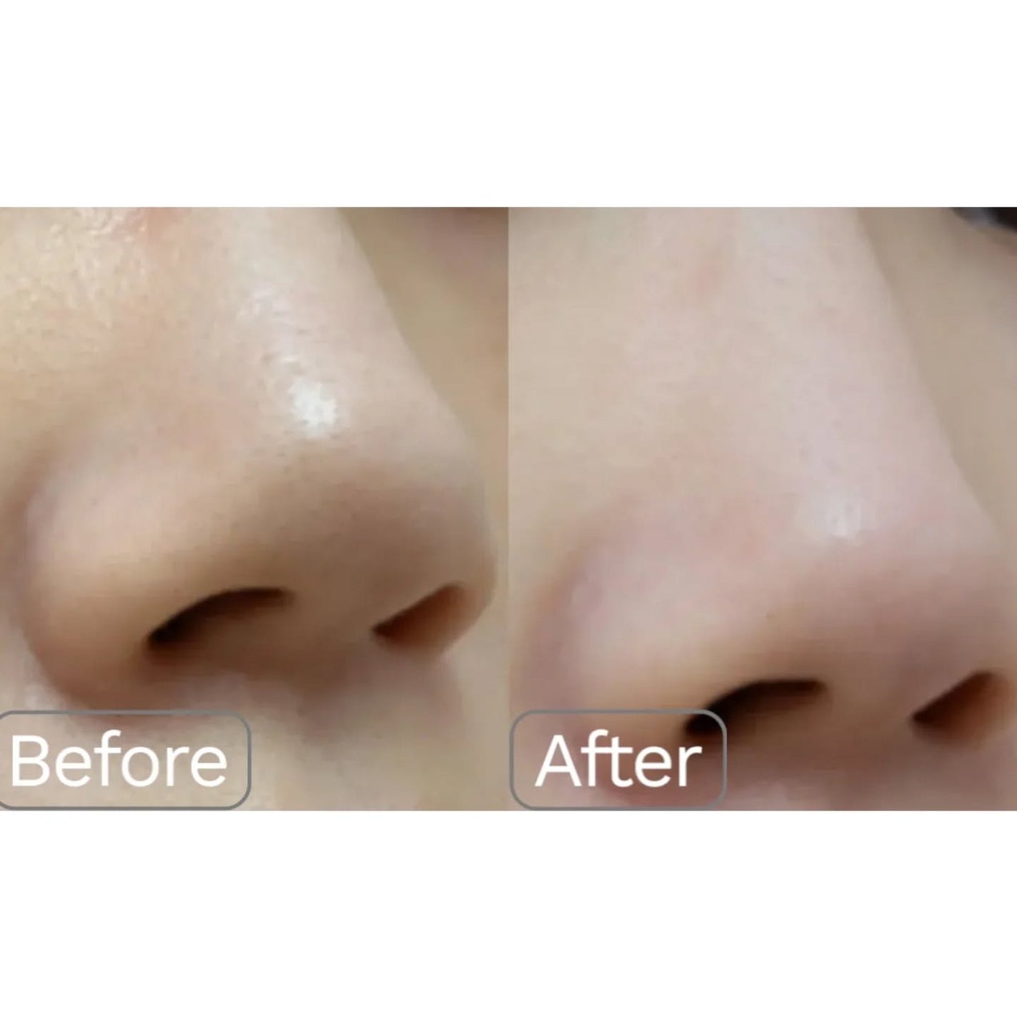 ウィロウPHA5%角質ケアトナー/opigen/化粧水を使ったクチコミ(3枚目)