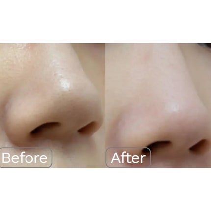 ウィロウPHA5%角質ケアトナー/opigen/化粧水を使ったクチコミ(3枚目)