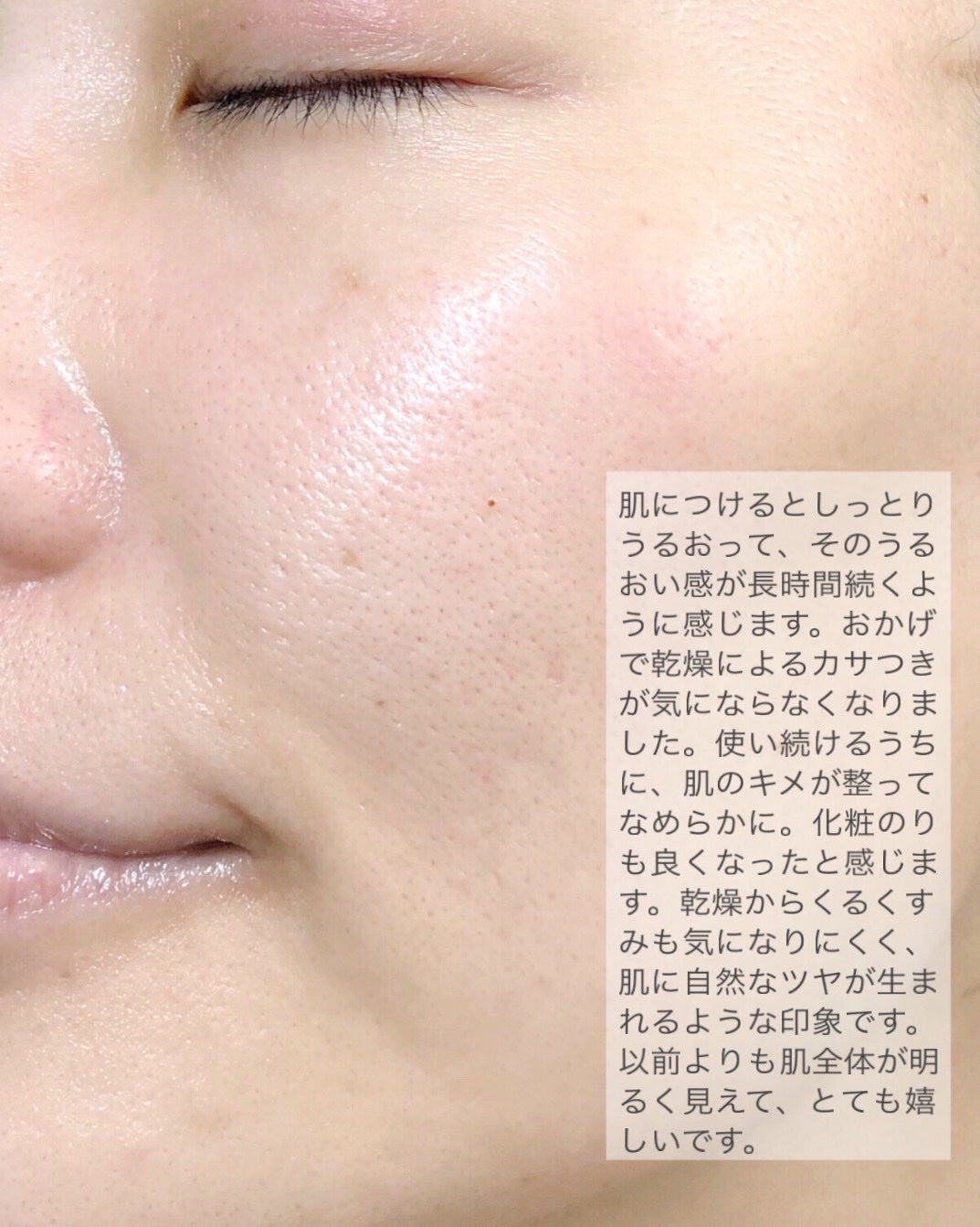 ピンクトーニング™︎ディープインショットアンプル/CNP Laboratory/美容液を使ったクチコミ(4枚目)