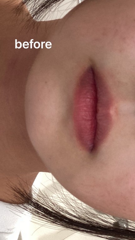 デュー ドロップ ティント/Coralhaze/リップティントを使ったクチコミ(4枚目)