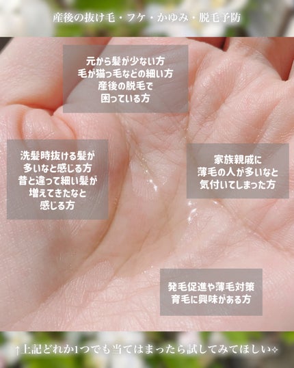 薬用育毛ローション RANMU/RANMU/頭皮ローションを使ったクチコミ(5枚目)