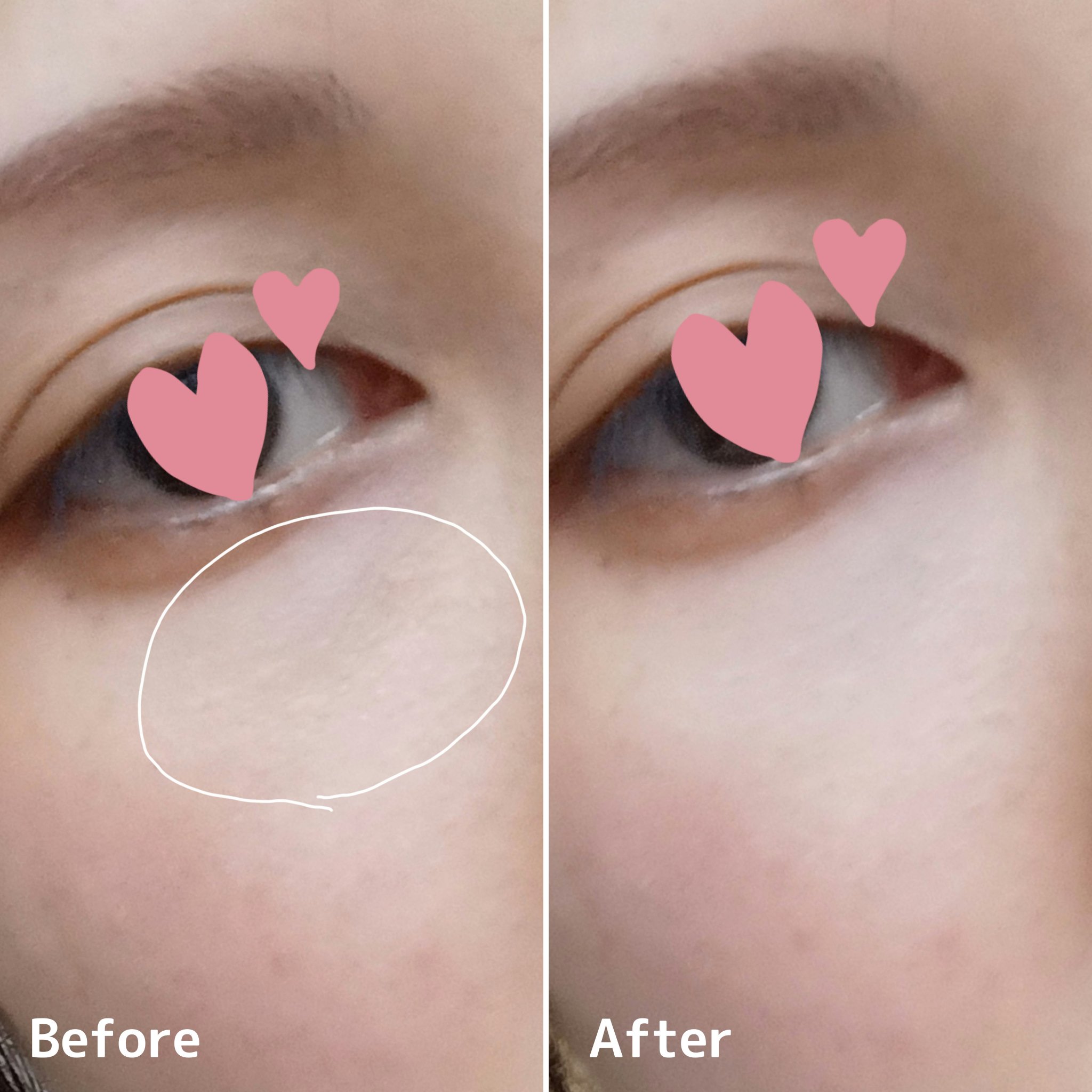 マシュマロフィニッシュパウダー/キャンメイク/プレストパウダーを使ったクチコミ（2枚目）