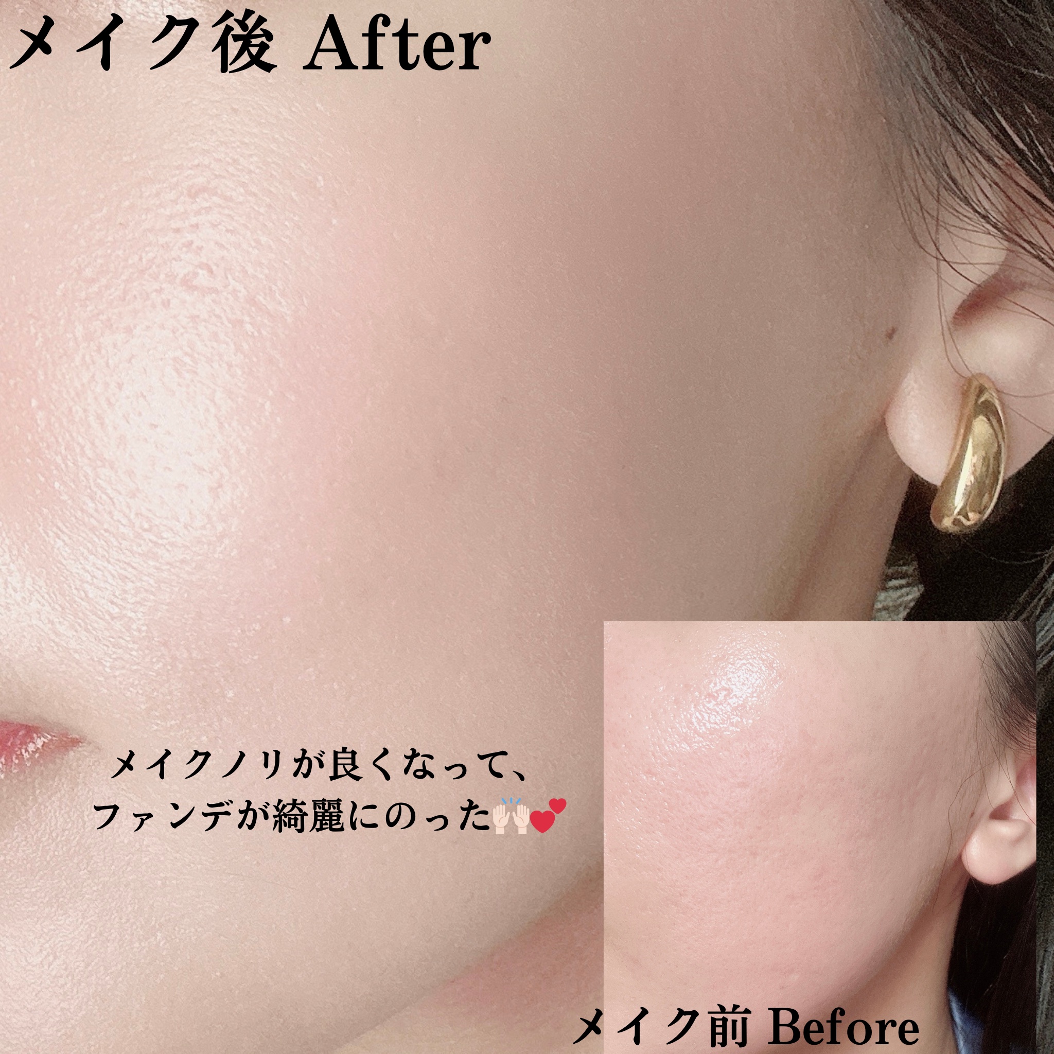 スキンブースティングフォルテセラム/essenciel/美容液を使ったクチコミ（3枚目）