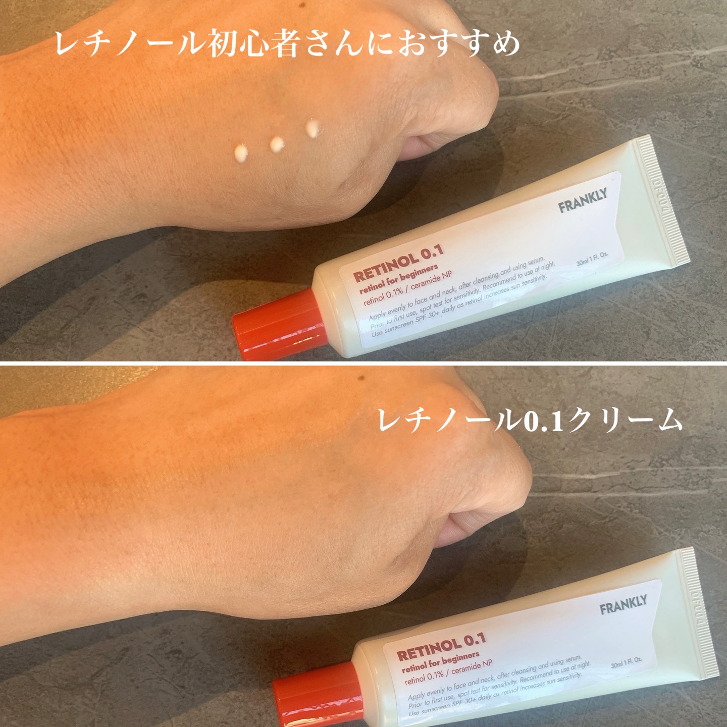 レチノール0.1％クリーム/Frankly/フェイスクリームを使ったクチコミ（2枚目）