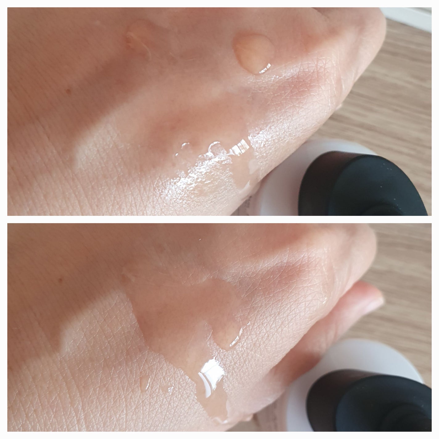 RXザ・アルファアルブチン2 ニキビ跡ケアセラム/COSRX/美容液を使ったクチコミ(6枚目)