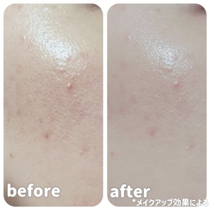 RMK リクイドファンデーション フローレスカバレッジ プラス/RMK/リキッドファンデーションを使ったクチコミ(4枚目)