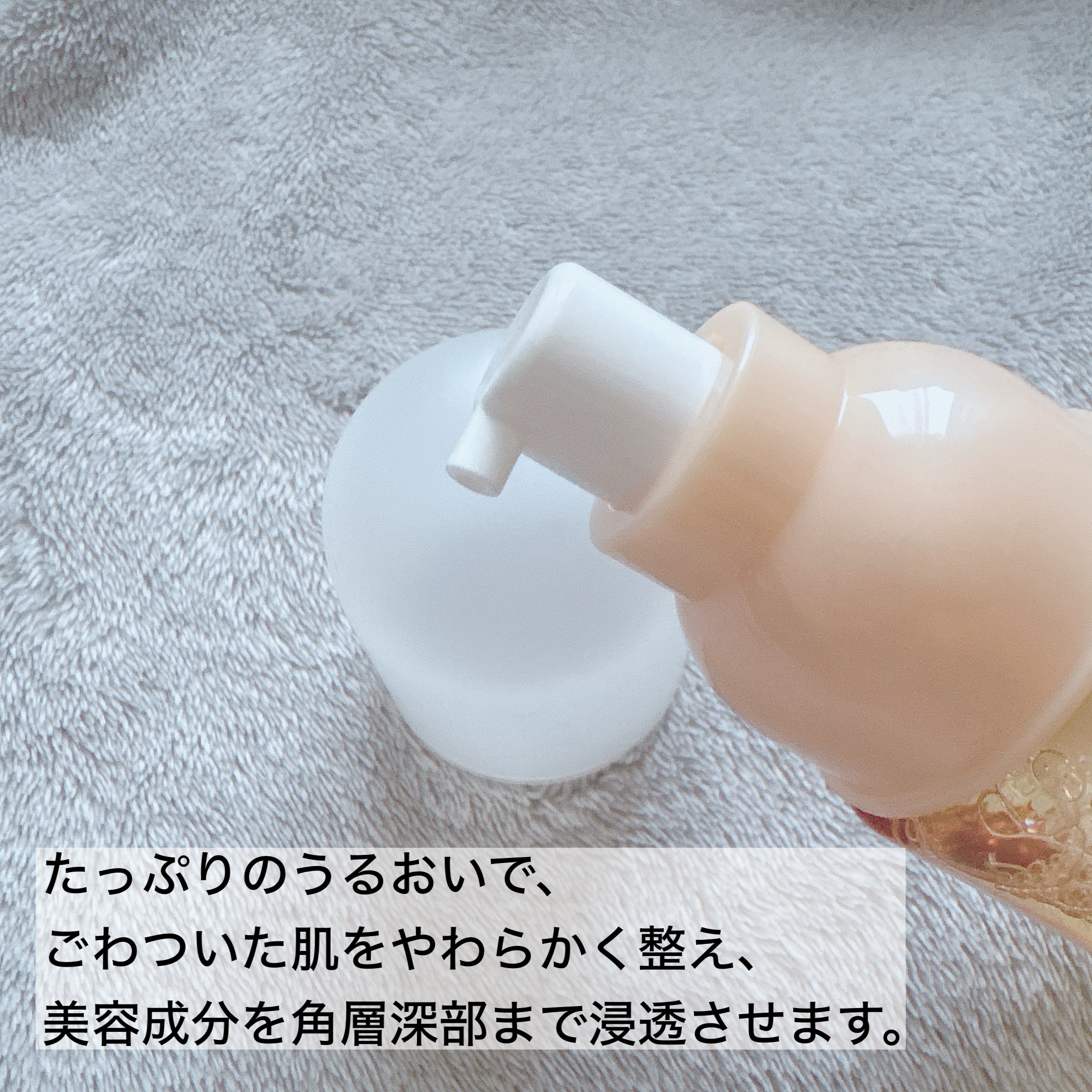 アクネケア ローション MB/d プログラム/化粧水を使ったクチコミ（2枚目）