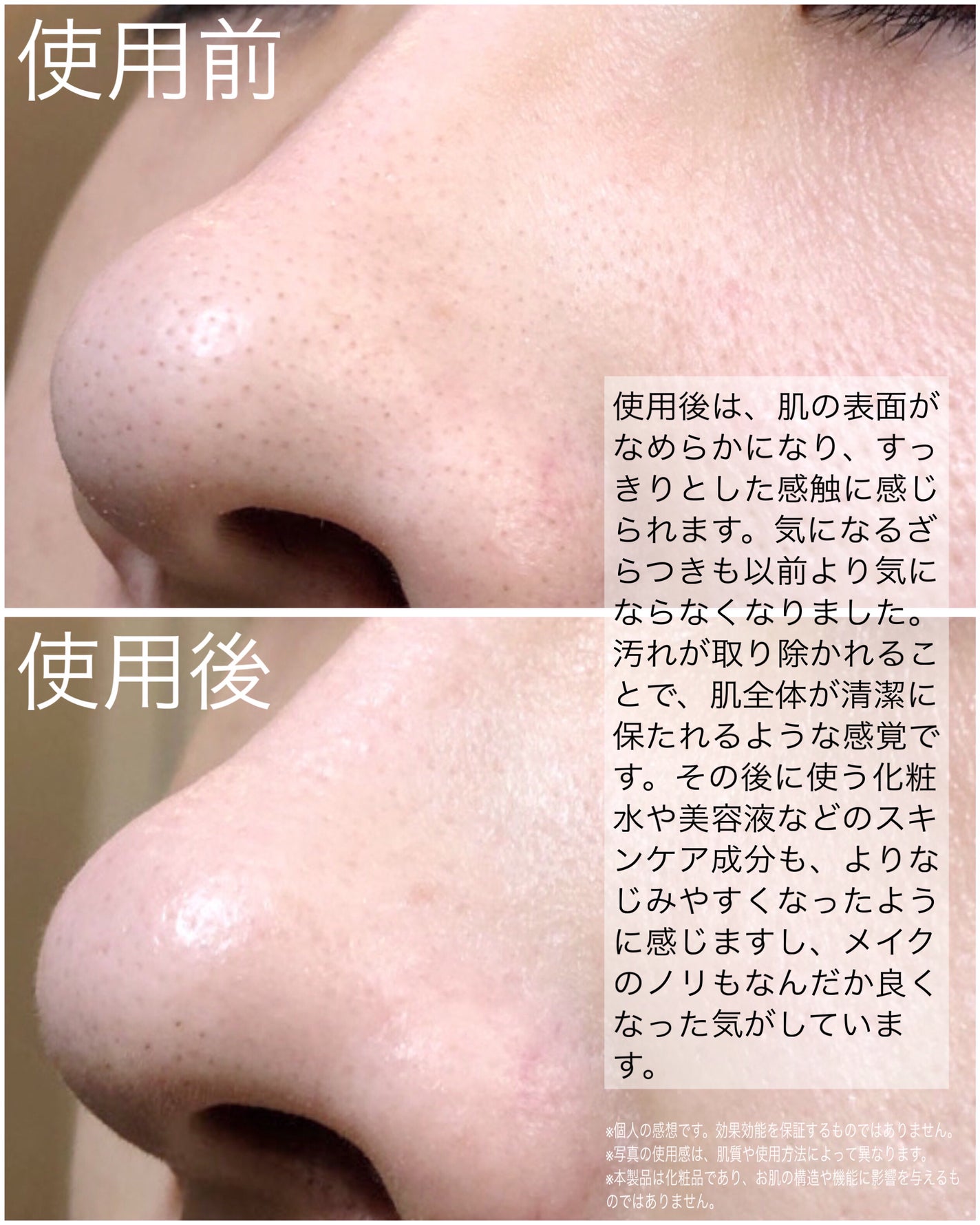 ナチュラルマイルドクリアノーズパック/ilso/シートマスク・パックを使ったクチコミ(4枚目)