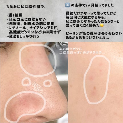 マンデリック インテンシブ 18%セラム/DR.WU/美容液を使ったクチコミ(3枚目)