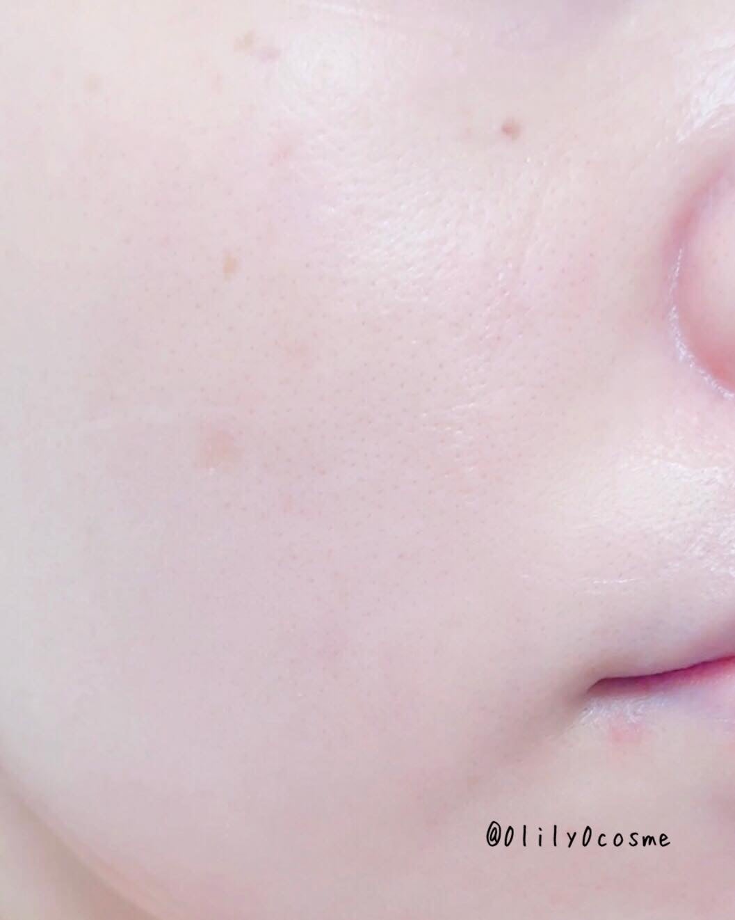 ユース ラディアンス ビタチノール セラム/primera/美容液を使ったクチコミ(7枚目)