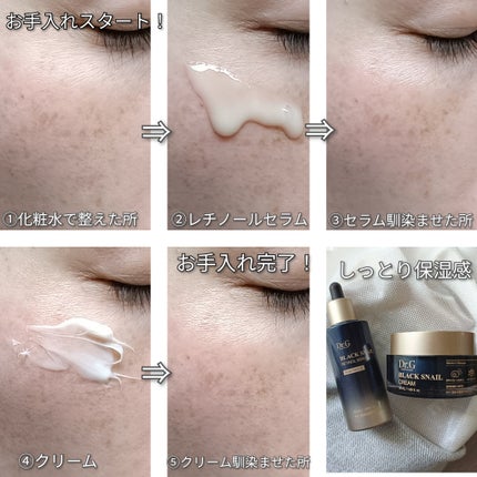 ブラックスネイル クリーム/Dr.G/フェイスクリームを使ったクチコミ(2枚目)