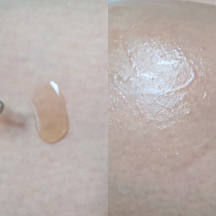 RXザ・アルファアルブチン2 ニキビ跡ケアセラム/COSRX/美容液を使ったクチコミ(4枚目)