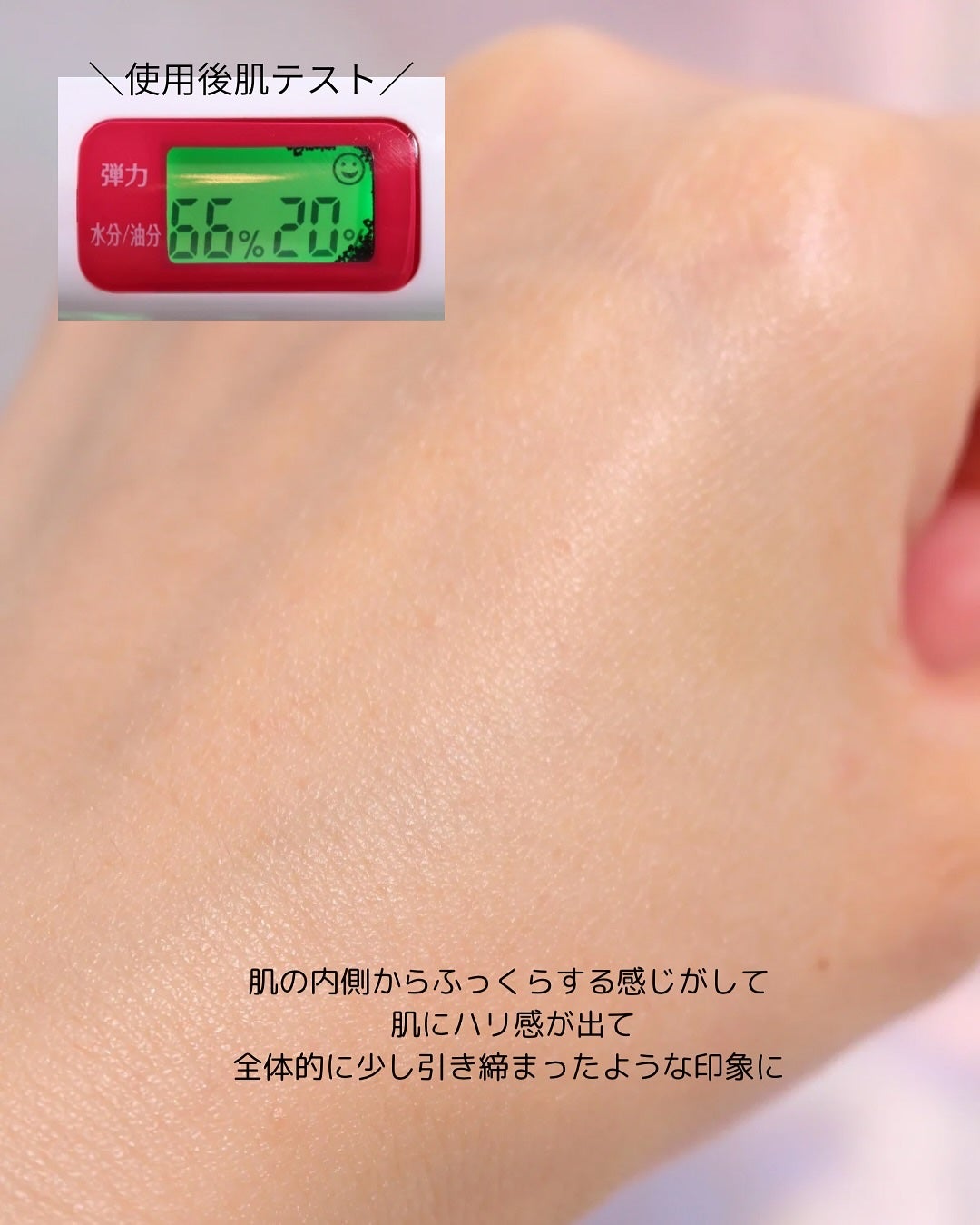 PDRNキューブセラム/DPPR/美容液を使ったクチコミ(5枚目)