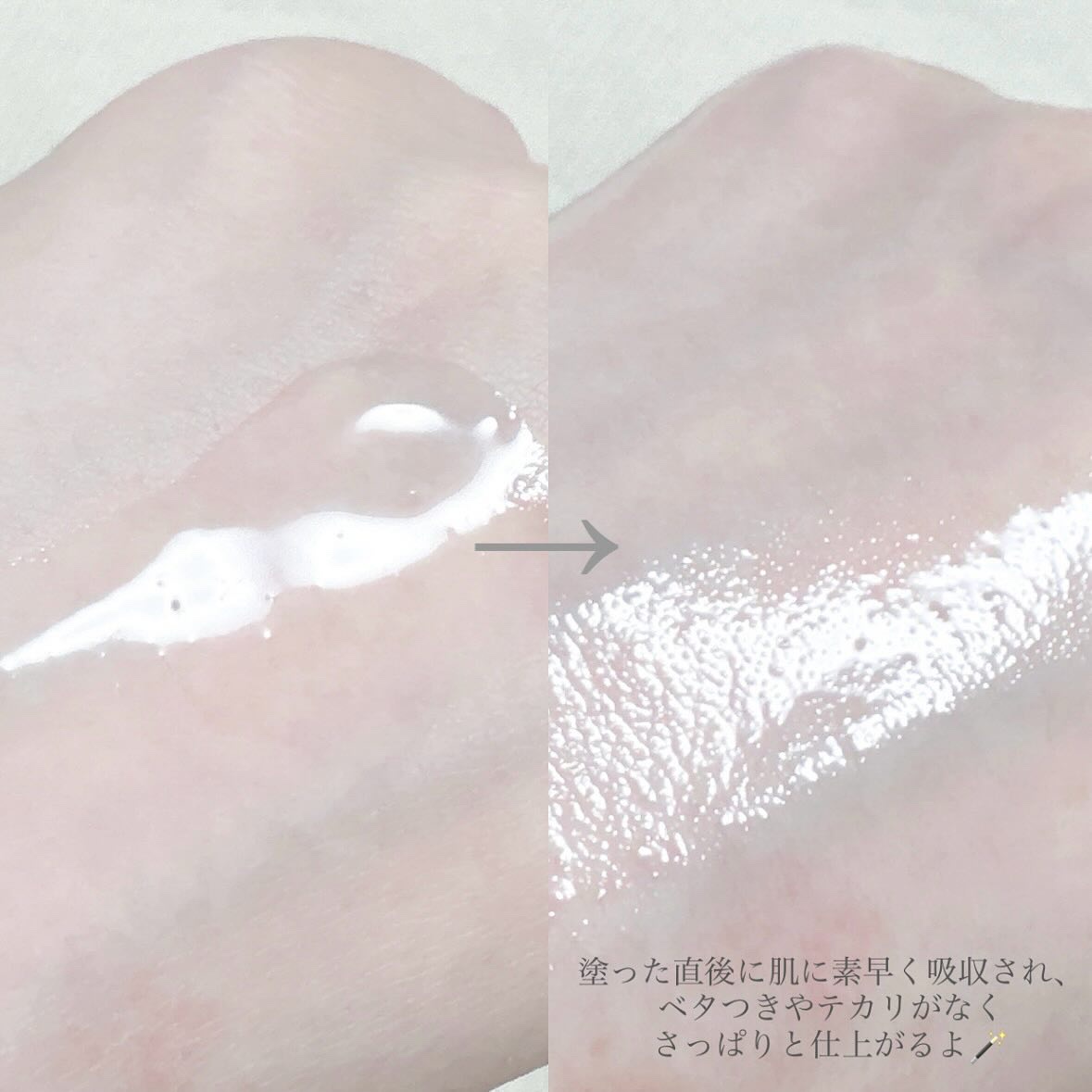 スキンブースティングフォルテセラム/essenciel/美容液を使ったクチコミ（3枚目）