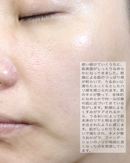 ReDRNエクソソームアンプル/Dr.nineteen/美容液を使ったクチコミ(4枚目)