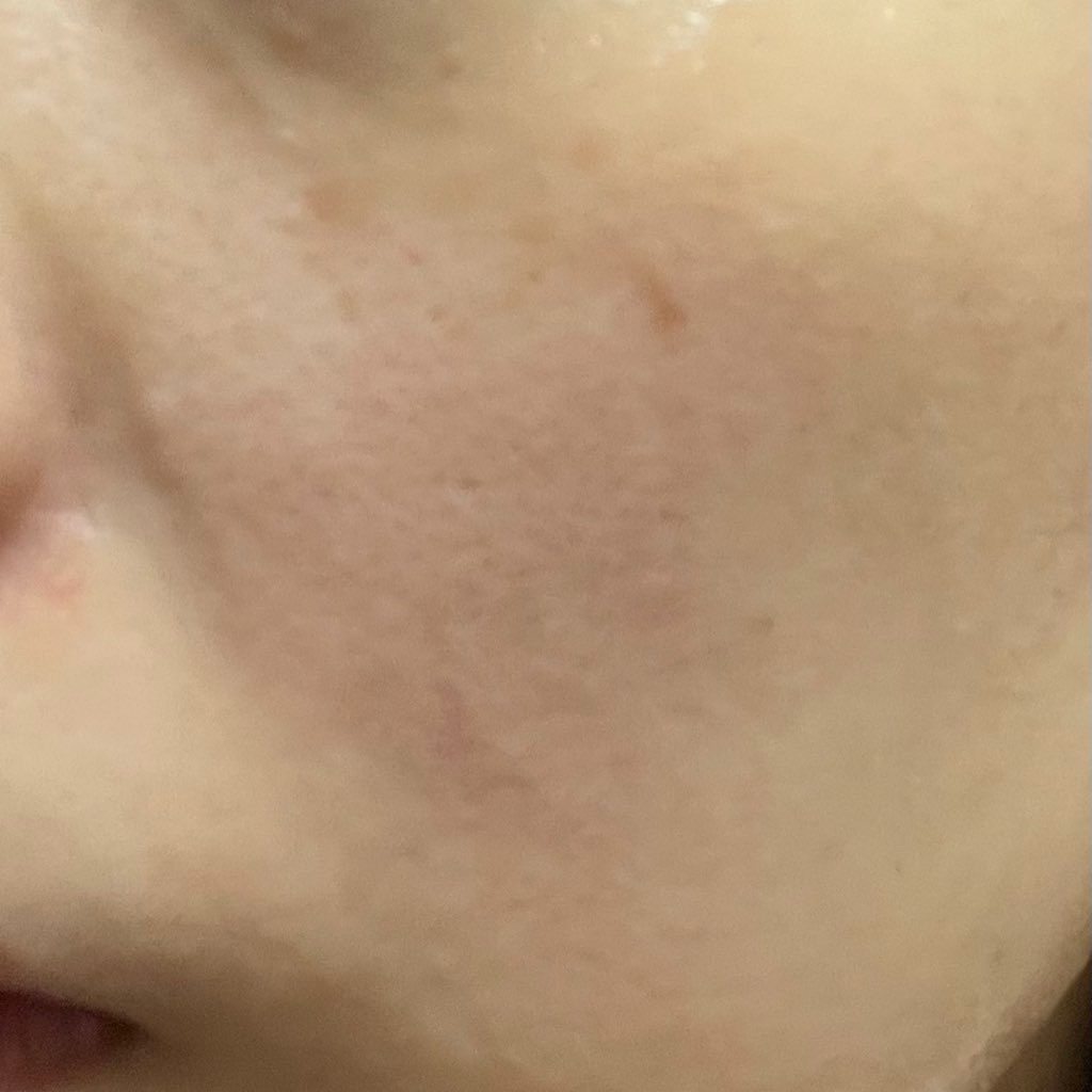 MENTHOLOGY クーリングマスクパック/menthology/シートマスク・パックを使ったクチコミ（3枚目）