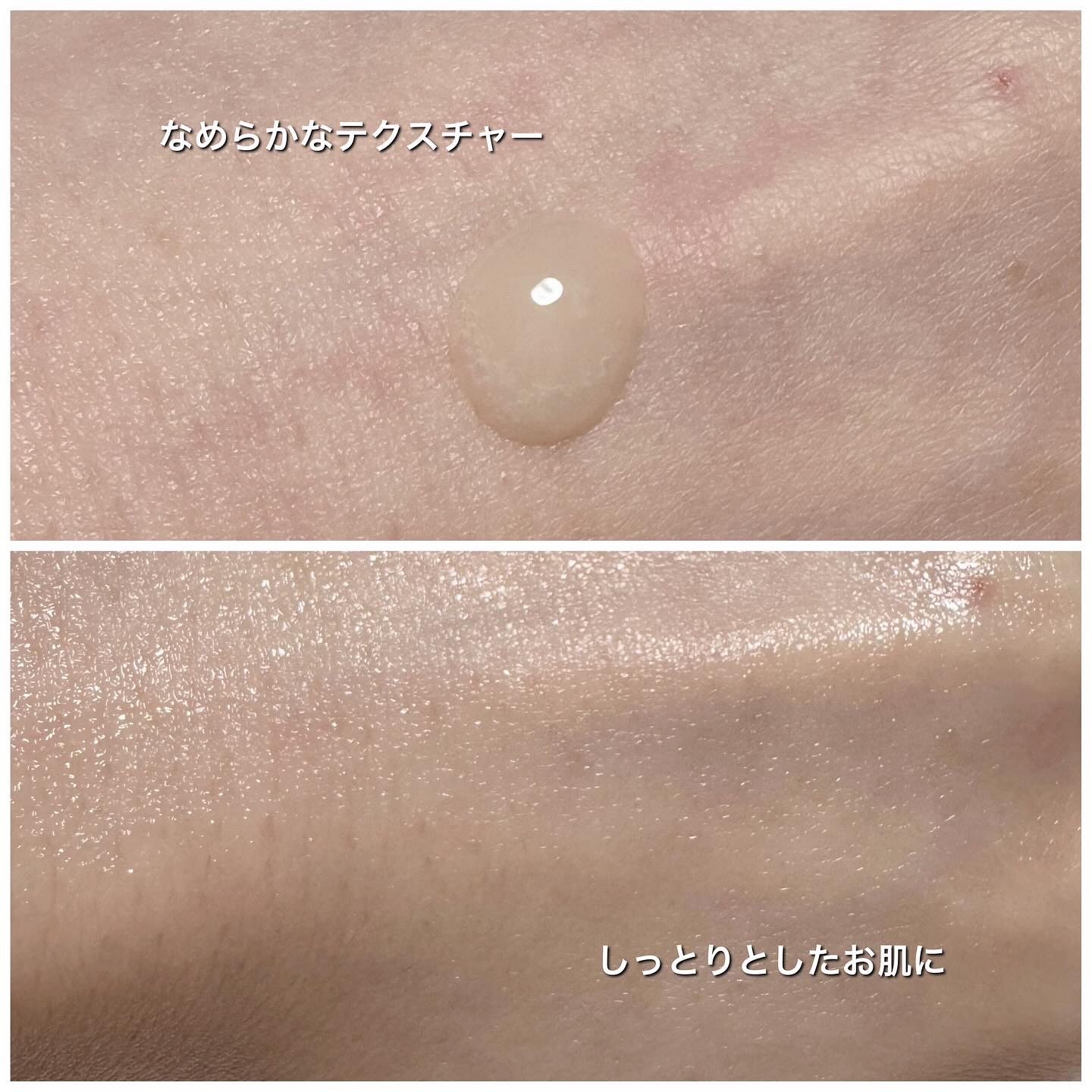 αアルブチン5%美容液/コスデバハ/美容液を使ったクチコミ（3枚目）