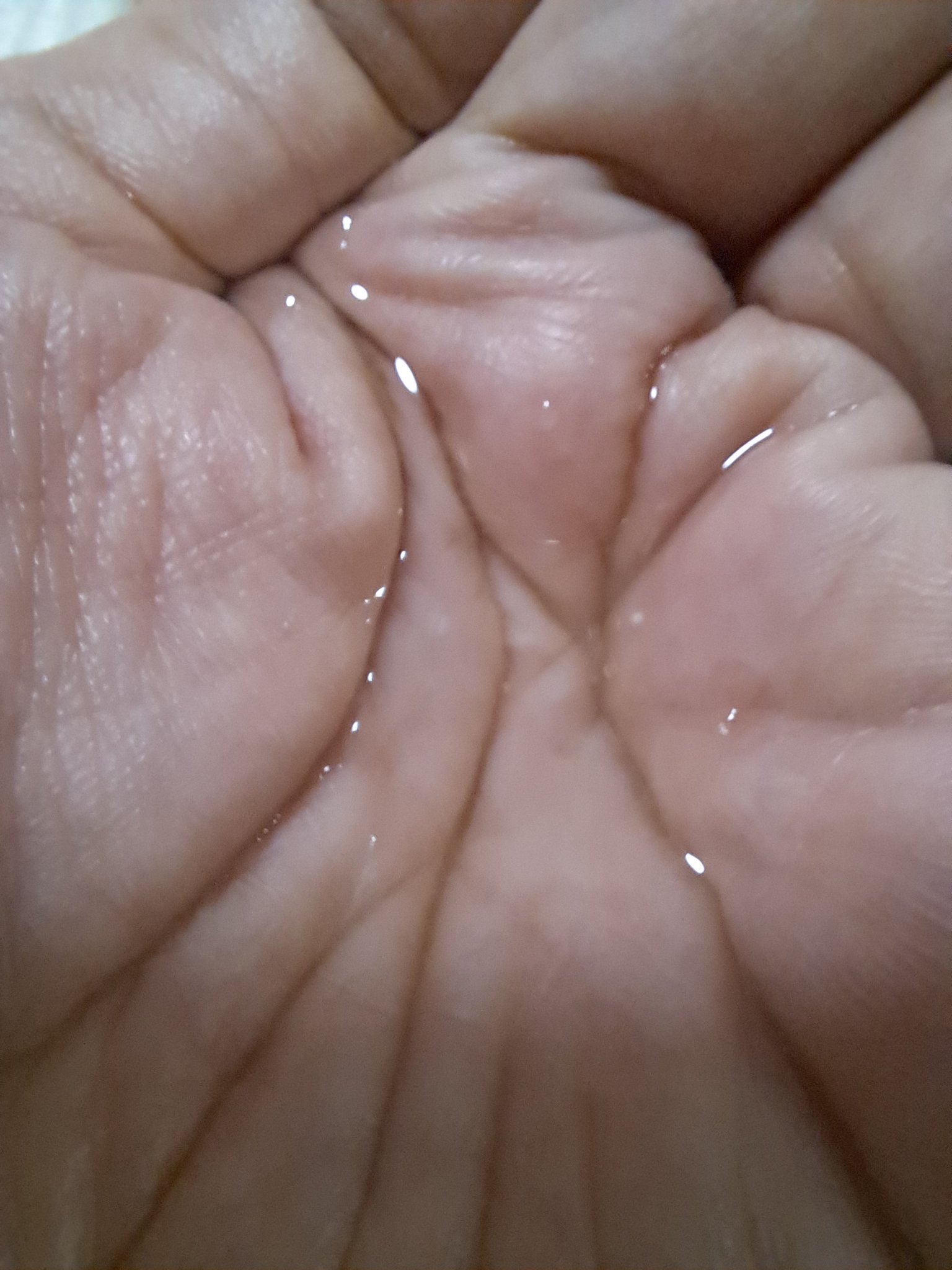 生VC美白美容液/Yunth/美容液を使ったクチコミ（3枚目）