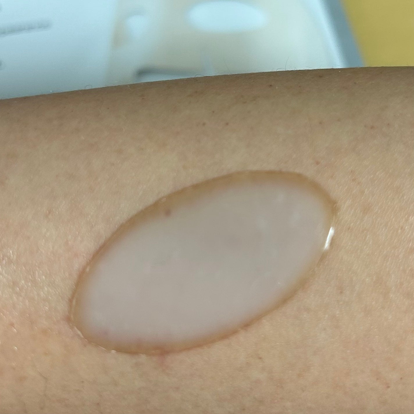 RXザ・アルファアルブチン2 ニキビ跡ケアセラム/COSRX/美容液を使ったクチコミ(7枚目)