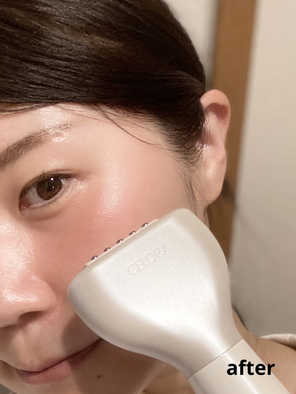 ペンタショット/CELORABY/美顔器・マッサージを使ったクチコミ（2枚目）