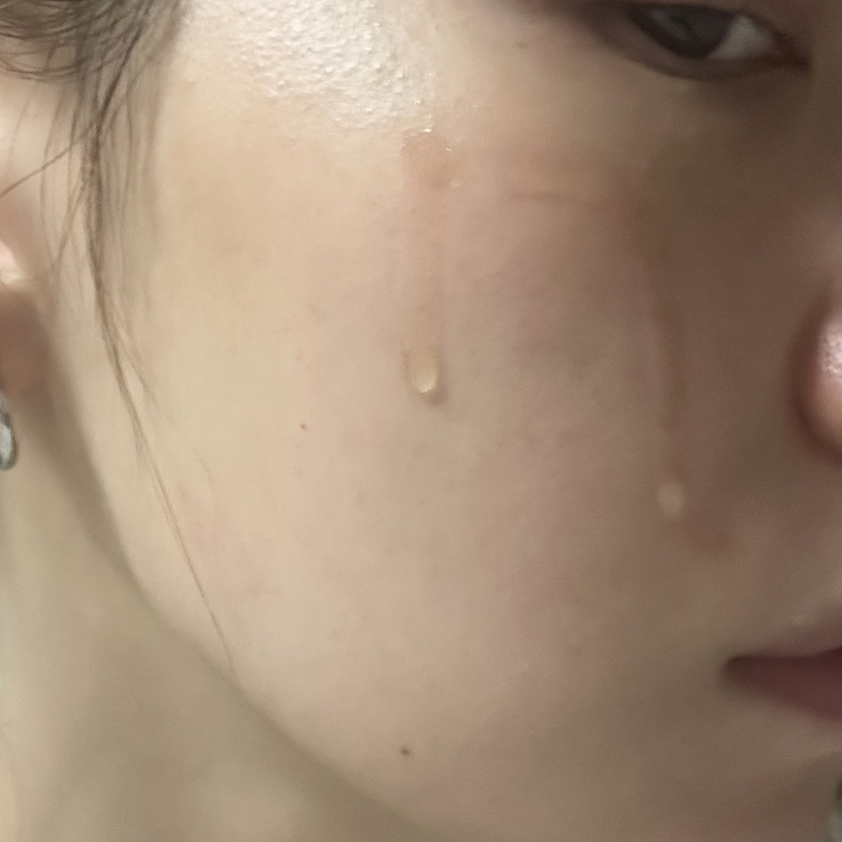 RXザ・アルファアルブチン2 ニキビ跡ケアセラム/COSRX/美容液を使ったクチコミ（3枚目）