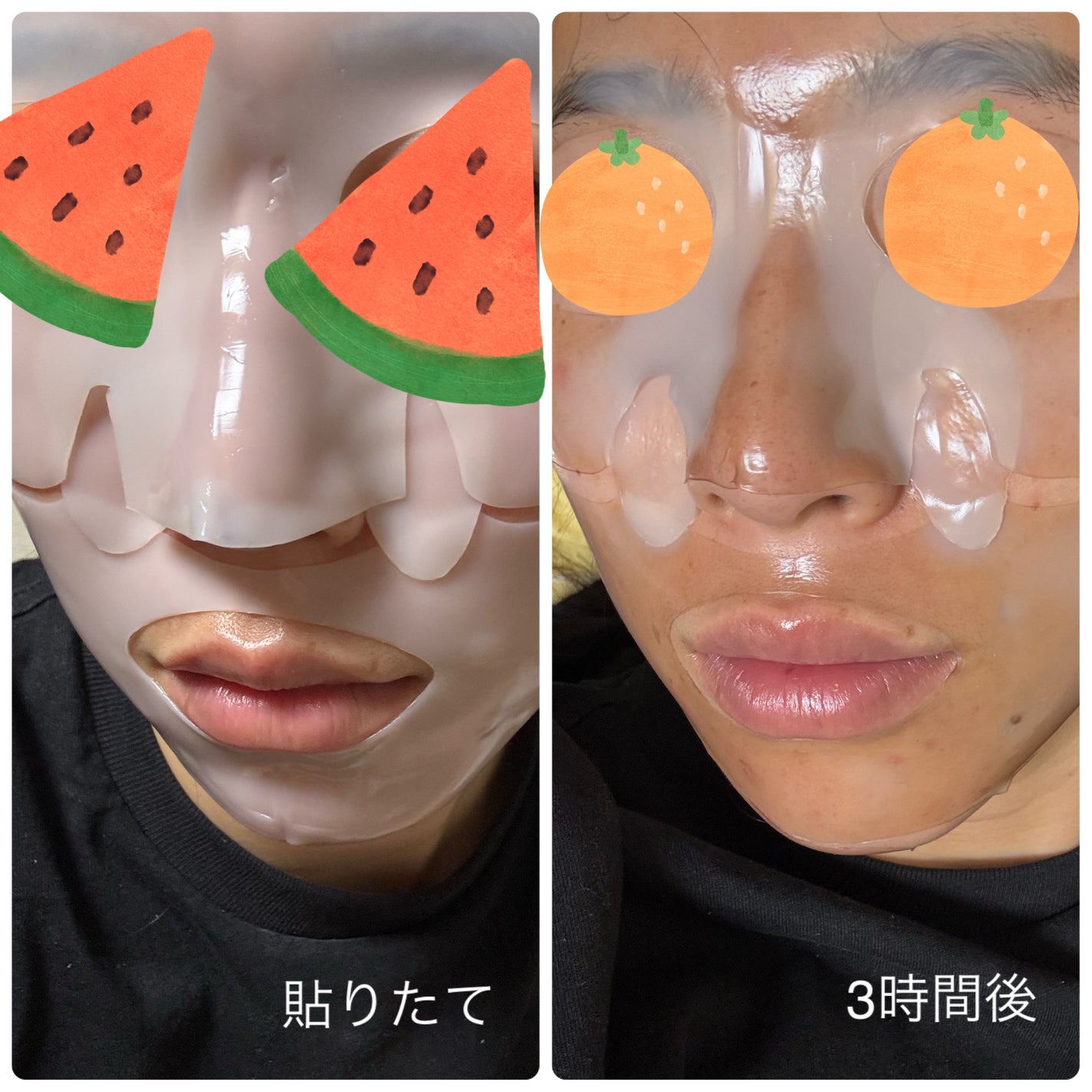 RXザ・アルファアルブチン2 ニキビ跡ケアセラム/COSRX/美容液を使ったクチコミ(6枚目)