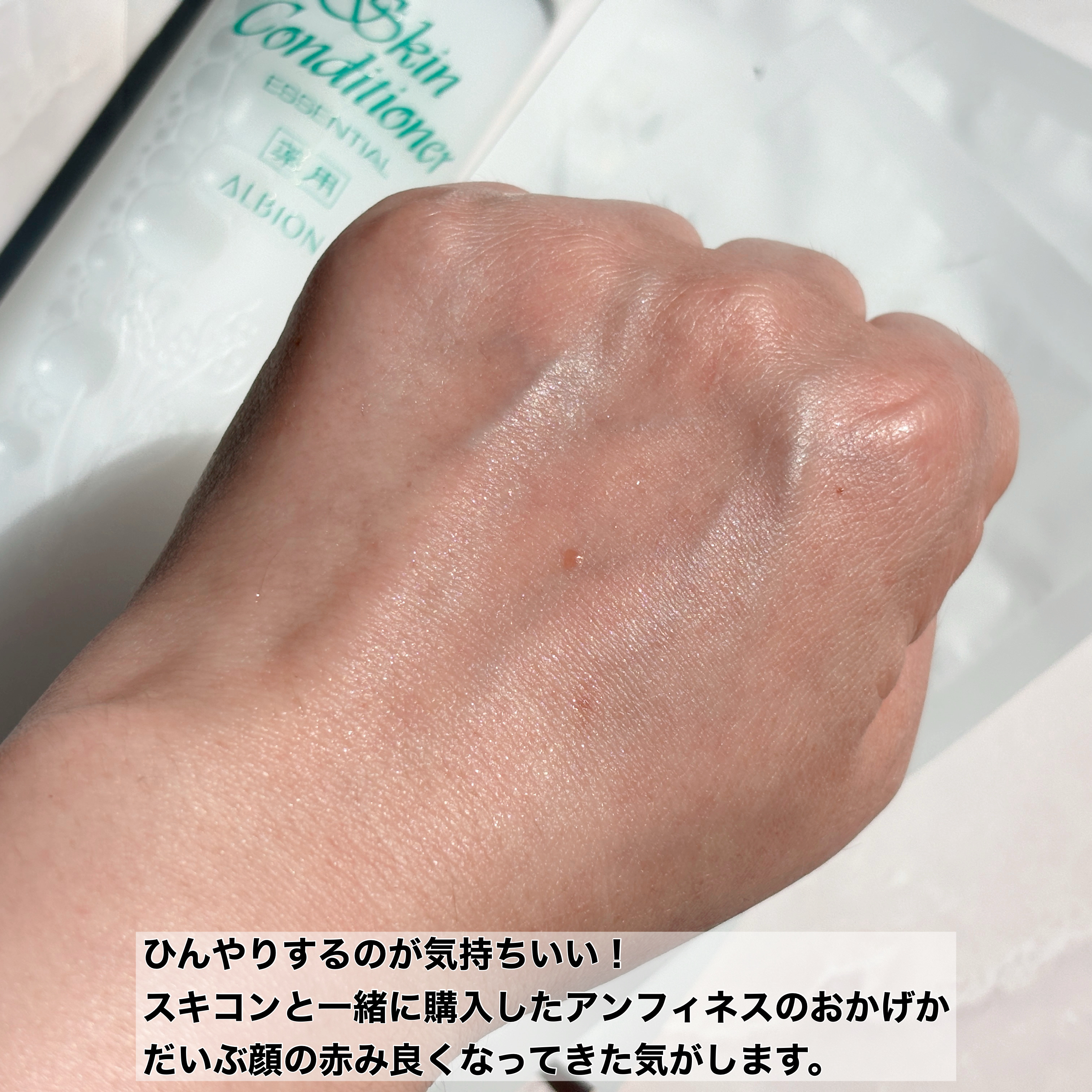  薬用スキンコンディショナーエッセンシャル N/ALBION/化粧水を使ったクチコミ（3枚目）