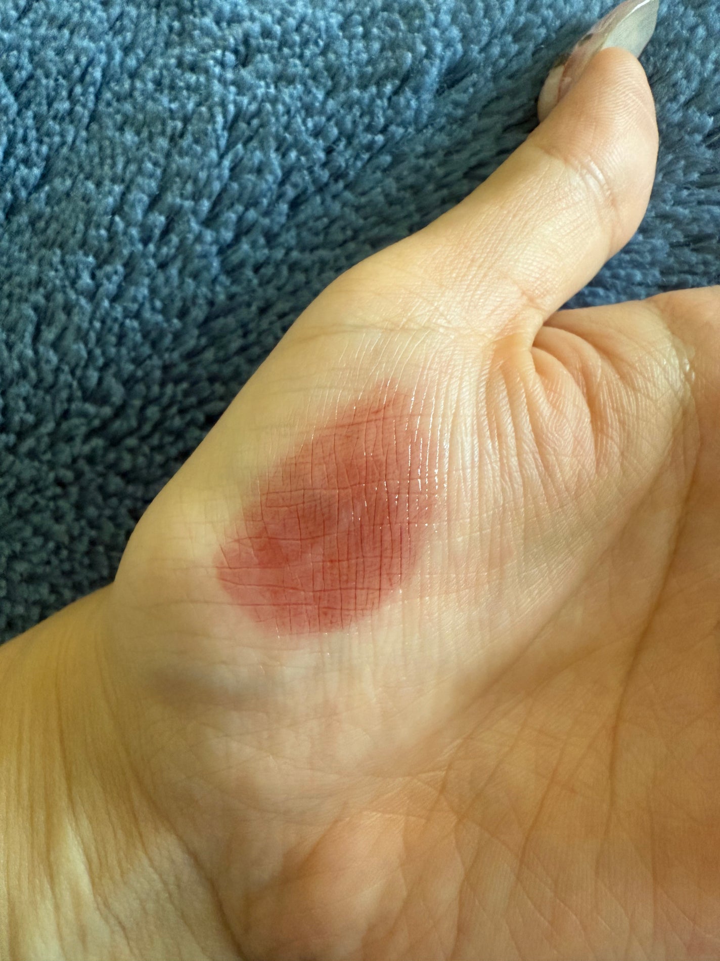 デュー ドロップ ティント/Coralhaze/リップティントを使ったクチコミ(5枚目)