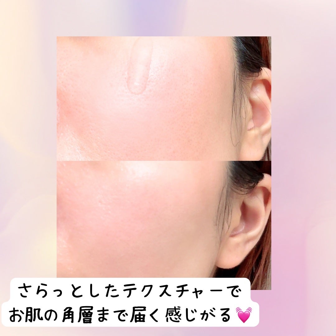 ひなあお|フォロバ100% on LIPS 「essenciel【スキンブーストフォルテセラム】肌の奥から湧..」(3枚目)