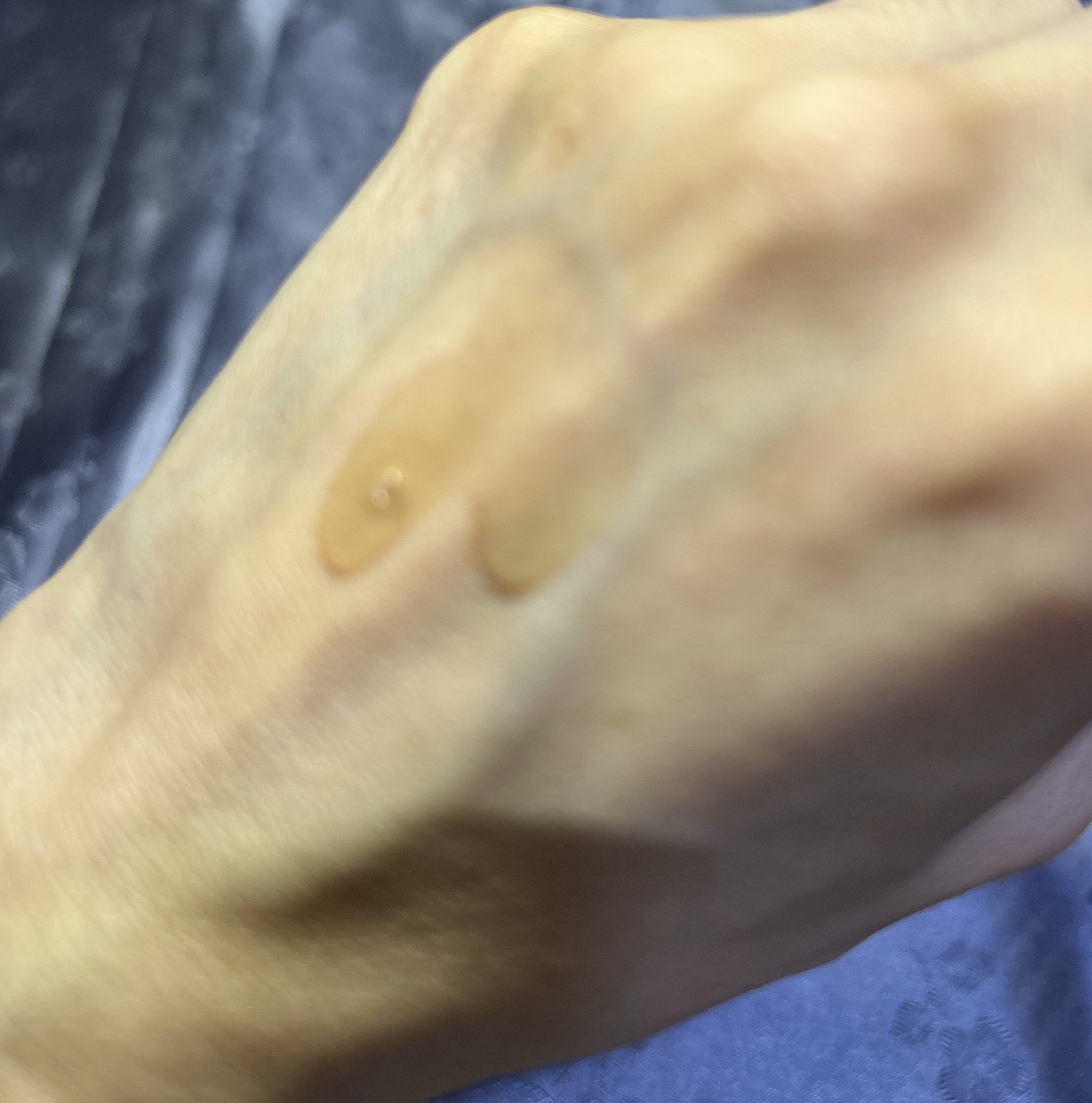 PDRNカフェインショット/IOPE/美容液を使ったクチコミ（3枚目）