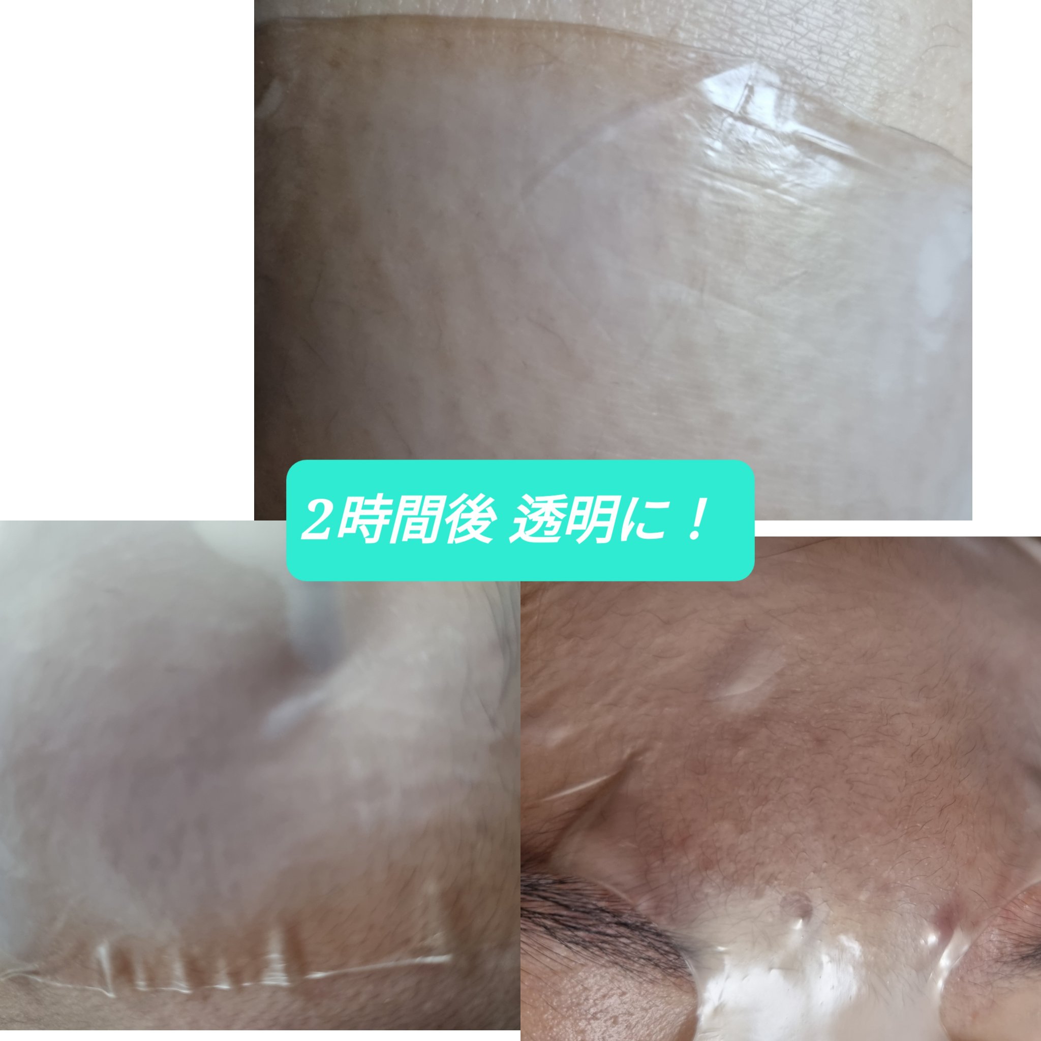 RXザ・アルファ アルブチン ハイドロゲルパック/COSRX/シートマスク・パックを使ったクチコミ（3枚目）