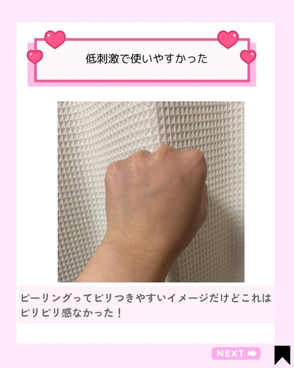 Kana on LIPS 「✨毛穴ごっそり!つるん肌の秘密🫧\高濃度10.1%ピーリング成..」(5枚目)